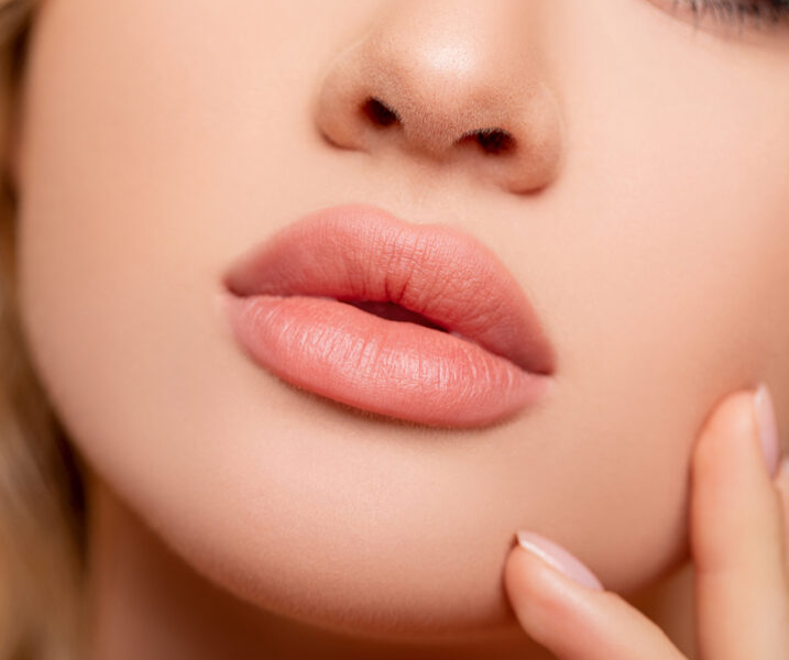 Lip Fillers in Las Vegas, NV