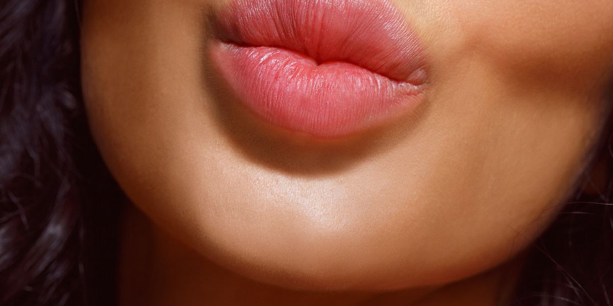 Lip Fillers