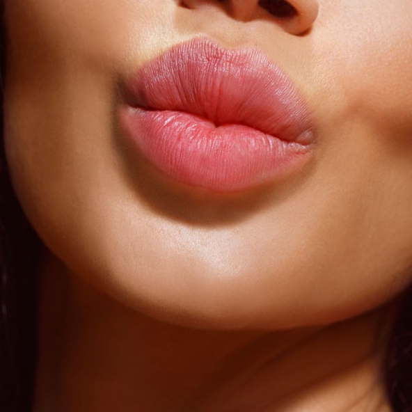 Lip Fillers